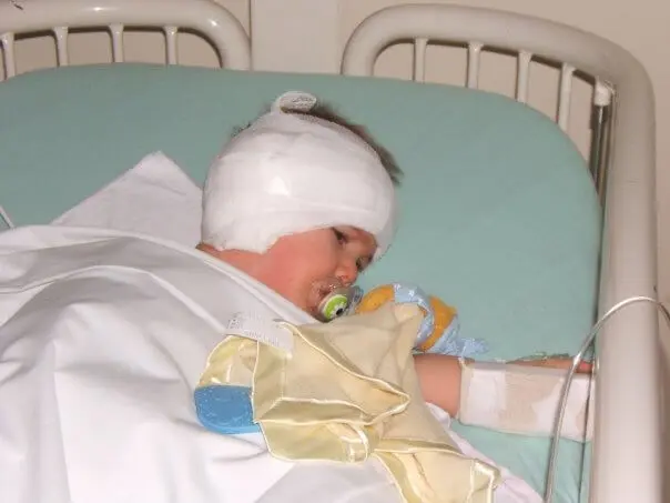 Toddler in a hospital bed post cochlear Implant surgery