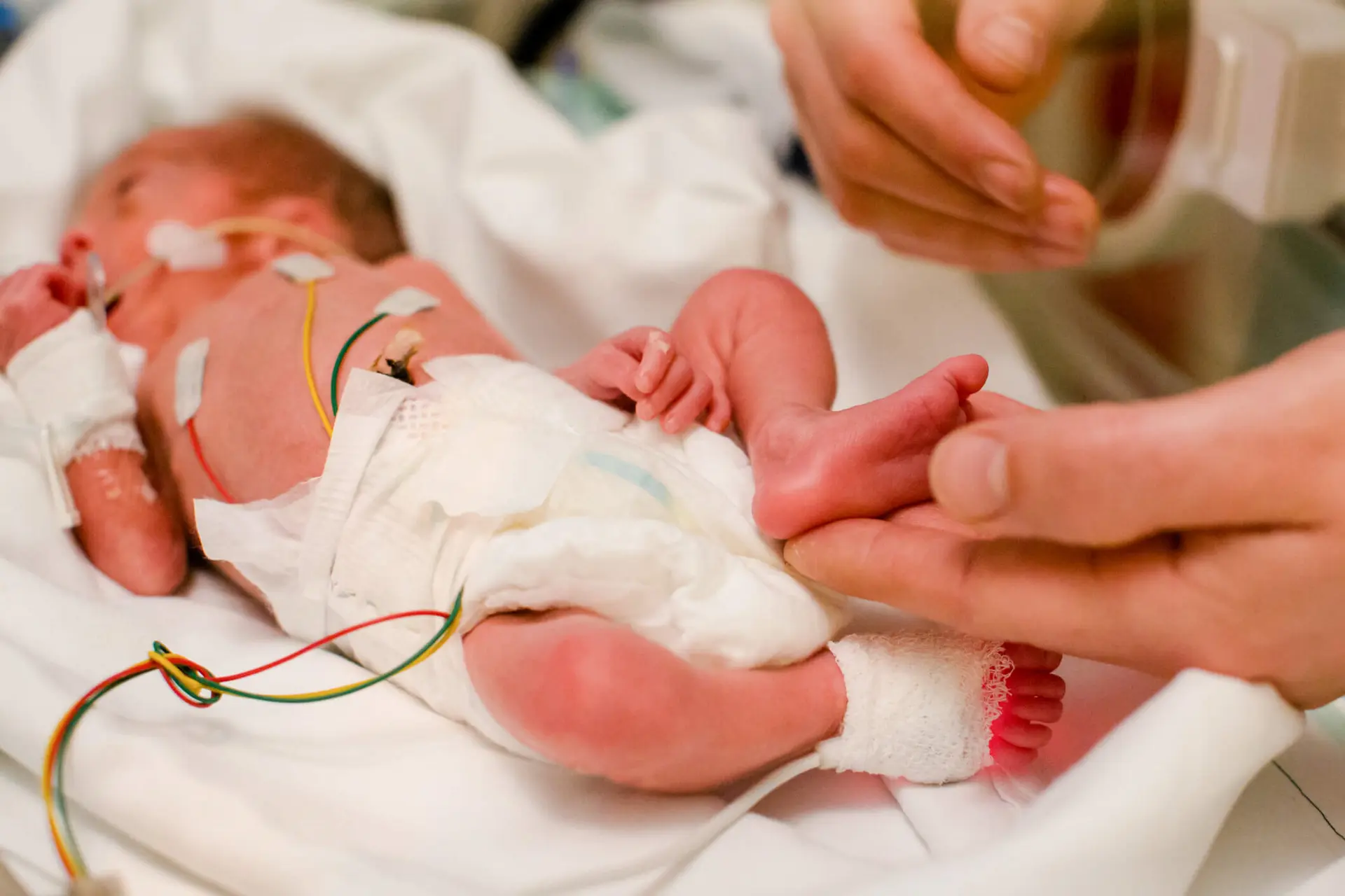 Raising Awareness of Early Arrivals: World Prematurity Day