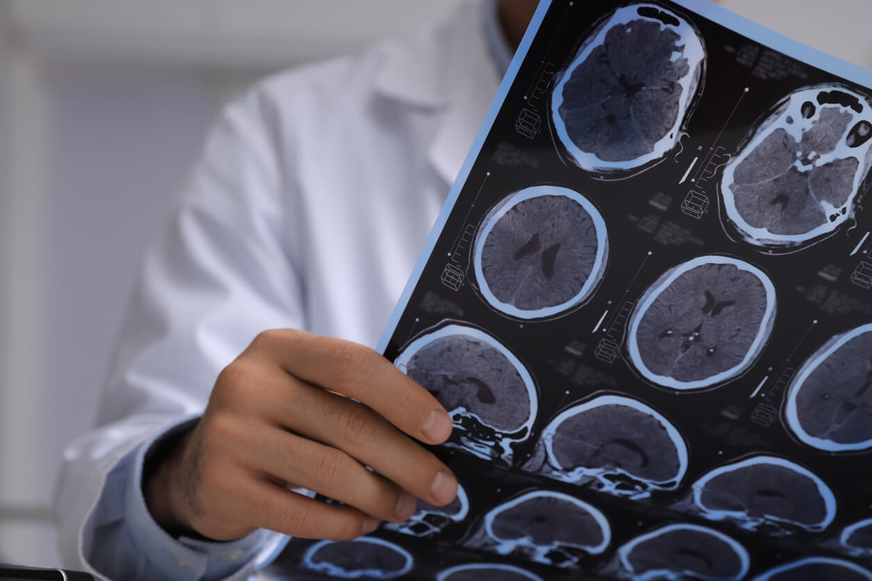 Ontario Catastrophic Brain Injury Lawyers.
